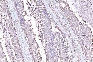 IHC analysis of PLP2 using anti-PLP2 antibody (ABIN7600320).