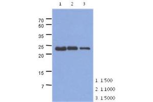 Image no. 1 for anti-Slow Skeletal Troponin I (TNNI1) (AA 1-187), (N-Term) antibody (ABIN1449413)