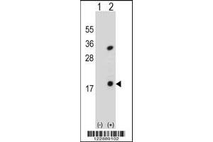 Western blot analysis of PLA2G1B using rabbit polyclonal PLA2G1B Antibody using 293 cell lysates (2 ug/lane) either nontransfected (Lane 1) or transiently transfected (Lane 2) with the PLA2G1B gene.