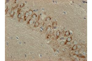 Immunohistochemistry (IHC) image for anti-Syntaxin 16 (STX16) (AA 1-302) antibody (ABIN1742232)