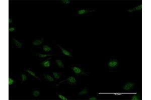 Immunofluorescence of purified MaxPab antibody to MSX2 on HeLa cell. (Msx2/Hox8 anticorps  (AA 1-267))