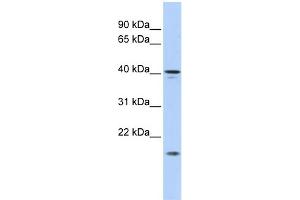 WB Suggested Anti-SLAIN1 Antibody Titration: 0. (SLAIN1 anticorps  (Middle Region))