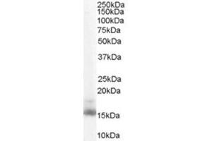 Image no. 1 for anti-Retinol Binding Protein 1, Cellular (RBP1) (C-Term) antibody (ABIN374530) (RBP1 anticorps  (C-Term))