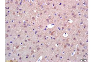 Formalin-fixed and paraffin embedded rat brain labeled with Anti-PAPOA Polyclonal Antibody, Unconjugated (ABIN1714857) at 1:200 followed by conjugation to the secondary antibody and DAB staining.