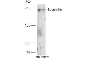 Mouse heart lysates probed with Rabbit Anti-Supervillin Polyclonal Antibody, Unconjugated (ABIN1714235) at 1:300 overnight at 4 °C. (Supervillin anticorps  (AA 51-150))