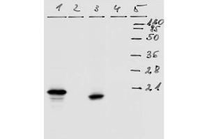 Western-Blot analysis of HPV-18 E7 protein. (HPV18 E7 anticorps  (AA 36-70))