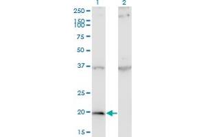 Western Blot analysis of IFNA1 expression in transfected 293T cell line by IFNA1 monoclonal antibody (M07), clone 3C6.