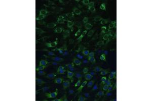 Immunofluorescence analysis of C6 cells using eEF1G Polyclonal Antibody (ABIN6133514, ABIN6139951, ABIN6139952 and ABIN6223877) at dilution of 1:100 (40x lens).