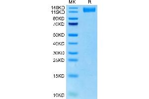 Rhesus macaque VEGF R2 on Tris-Bis PAGE under reduced condition. (VEGFR2/CD309 Protein (AA 20-764) (His tag))