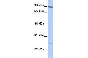 WB Suggested Anti-MARCH2 Antibody Titration:  0. (MARCH2 anticorps  (C-Term))