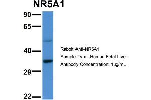 Host:  Rabbit  Target Name:  NR5A1  Sample Type:  Human Fetal Liver  Antibody Dilution:  1.