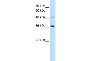 WB Suggested Anti-IRX1 Antibody Titration:  5. (IRX1 anticorps  (N-Term))