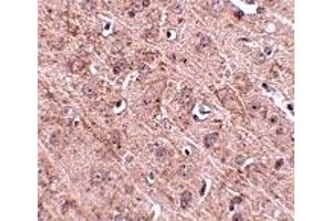 Immunohistochemistry (IHC) image for anti-GLE1 RNA Export Mediator (GLE1) (Middle Region) antibody (ABIN1030940) (GLE1 anticorps  (Middle Region))