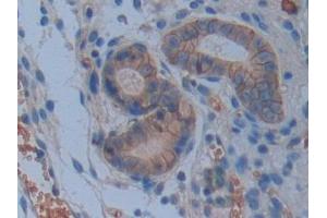 Detection of CD147 in Mouse Uterus Tissue using Polyclonal Antibody to Cluster Of Differentiation 147 (CD147)