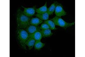 IF analysis of Acid Phosphatase/ACP5 using anti-Acid Phosphatase/ACP5 antibody (ABIN7601574). (ACP5 anticorps  (AA 39-325))