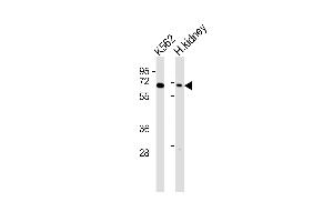 All lanes : Anti-Arylsulfatase D Antibody at 1:1000 dilution Lane 1: K562 whole cell lysates Lane 2: human kidney lysates Lysates/proteins at 20 μg per lane. (Arylsulfatase D anticorps)