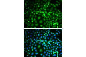 Immunofluorescence analysis of MCF-7 cells using RUVBL2 antibody. (RUVBL2 anticorps  (AA 1-463))