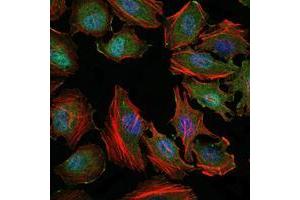 Immunofluorescence analysis of Hela cells using MAP3K5 mouse mAb (green).