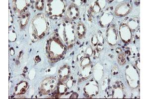 Image no. 2 for anti-Dual Specificity Phosphatase and Pro Isomerase Domain Containing 1 (DUPD1) antibody (ABIN1497927)