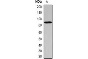 Western blot analysis of SCYL1 expression in Hela (A) whole cell lysates. (SCYL1 anticorps)