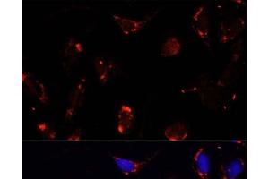 Immunofluorescence analysis of U-2 OS cells using TBRG4 Polyclonal Antibody at dilution of 1:100. (TBRG4 anticorps)