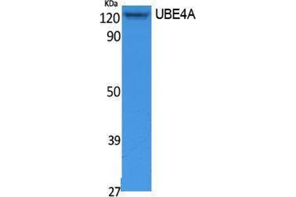 UBE4A 抗体  (N-Term)
