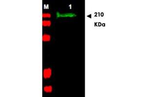 Western blot using SLIT2 polyclonal antibody  shows detection of a band at ~165 KDa (Lane 1) corresponding to SLIT2 present in a chicken spinal cord whole cell lysate (arrowhead). (SLIT2 anticorps  (AA 484-500))