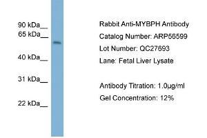 WB Suggested Anti-MYBPH  Antibody Titration: 0. (MYBPH anticorps  (Middle Region))
