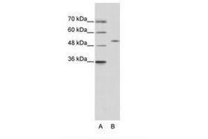 Image no. 2 for anti-Zinc Finger Protein 555 (ZNF555) (AA 128-177) antibody (ABIN6736215) (ZNF555 anticorps  (AA 128-177))