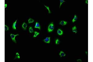 Immunofluorescence staining of A549 cells with ABIN7147051 at 1:133, counter-stained with DAPI.