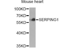 Western blot analysis of extracts of mouse heart, using SERPING1 Antibody (ABIN6290125) at 1:1000 dilution. (SERPING1 anticorps)