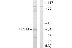 Western blot analysis of extracts from K562 cells, using CREM antibody. (CREM anticorps  (Internal Region))
