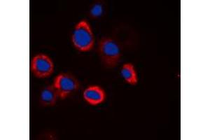 Immunofluorescent analysis of EGFR staining in HeLa cells. (EGFR anticorps  (Center))