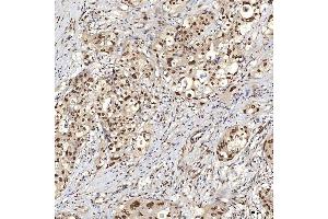 IHC analysis of U1A/SNRPA using anti-U1A/SNRPA antibody (ABIN7600891). (SNRPA1 anticorps  (AA 25-218))