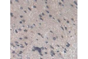 IHC-P analysis of Kidney tissue, with DAB staining. (Recoverin anticorps  (AA 2-200))