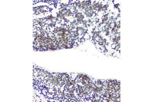 IHC analysis of RPA70 using anti-RPA70 antibody (ABIN6719369).
