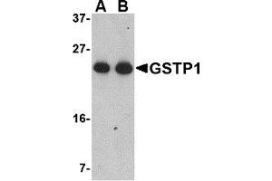 Western Blotting (WB) image for anti-Glutathione S-Transferase pi 1 (GSTP1) (Middle Region) antibody (ABIN1030946) (GSTP1 anticorps  (Middle Region))