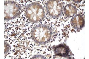 Image no. 2 for anti-ADP-Ribosylation Factor-Like 2 Binding Protein (ARL2BP) antibody (ABIN1496716)