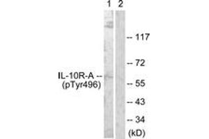 Western blot analysis of extracts from HuvEc cells, using IL-10R alpha (Phospho-Tyr496) Antibody. (IL-10RA anticorps  (pTyr496))