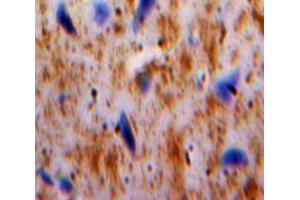 Used in DAB staining on fromalin fixed paraffin-embedded Brain tissue