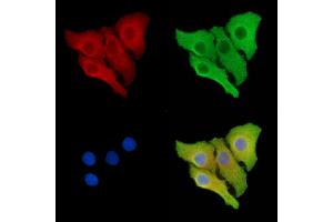ABIN6264421 and ABIN6278673 staining Hela cells by IF/ICC. (PRKAB2 anticorps  (N-Term))