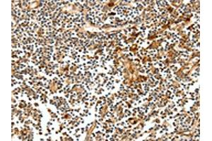 The image on the left is immunohistochemistry of paraffin-embedded Human tonsil tissue using ABIN7128894(CEACAM21 Antibody) at dilution 1/60, on the right is treated with fusion protein. (CEACAM21 anticorps)