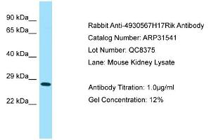WB Suggested Anti-4930567H17Rik Antibody   Titration: 1. (4930567H17Rik anticorps  (Middle Region))