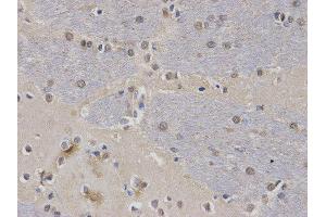 Immunohistochemistry (IHC) image for anti-Calcium/calmodulin-Dependent serine Protein Kinase (MAGUK Family) (CASK) antibody (ABIN1871447) (CASK anticorps)