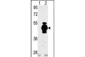 Western blot analysis of GF (arrow) using GF Antibody (N-term) 2017a. (GFAP anticorps  (N-Term))