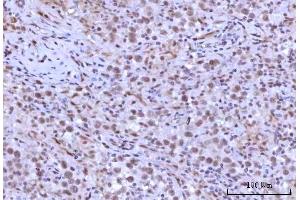IHC analysis of RNF40 using anti-RNF40 antibody (ABIN7602723).