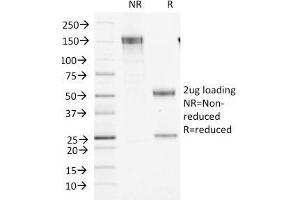 SDS-PAGE Analysis Purified Factor XIIIa Mouse Monoclonal Antibody (F13A1/1448).