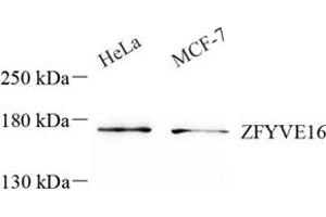 Western blot analysis of ZFYVE16 (ABIN7076283) at dilution of 1: 500 (ZFYVE16 anticorps)