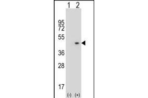 Western blot analysis of AZGP1 (arrow) using rabbit polyclonal AZGP1 Antibody (N-term) (ABIN390565 and ABIN2840895).