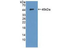 Detection of Recombinant PCI, Human using Polyclonal Antibody to Protein C Inhibitor (PCI)